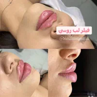 جسنواره سلول بنیادی و پروفایلو