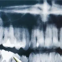 دستیار و پذیرش دندانپزشکی باسابقه خانم، شهر قدس