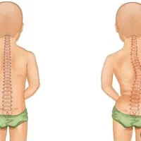 کلینیک ارتوپدی فنی قوز،گودی کمر،انحراف ستون فقرات|خدمات آرایشگری و زیبایی|فامنین, |دیوار