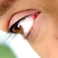 نیازمند مدل میکرو بنمژه