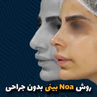جشنواره کانتورینگ Pro Face بدون جراحی و بیهوشی|خدمات آرایشگری و زیبایی|مشهد, هفت تیر (حافظ)|دیوار