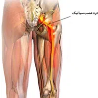 مجموعه تخصصی اصلاح ناهنجاری‌های اسکلتی|خدمات آرایشگری و زیبایی|قزوین, |دیوار