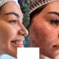 درمان تخصصی لک و کک ومک