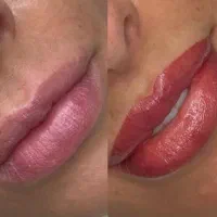 میکروبلیدینگ و میکروپیگمنتیشن ابرو