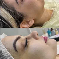 آموزش فشیال صورت. پاکسازی تخصصی و مدل پاکسازی پوست