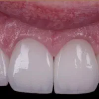 خدمات دندانپزشکی به صورت اقساط