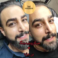 میکروبلیدینگ ابرو/رفع تیرگی لب/اسکالپ سر|خدمات آرایشگری و زیبایی|تهران, نیاوران|دیوار