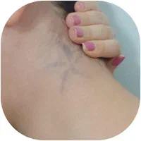 لیزر تاتو و خالکوبی و جوانسازی پوست(کر۰بنتراپی)|خدمات آرایشگری و زیبایی|محمدشهر, |دیوار