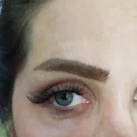 کاشت مژه هیدن فقط 200