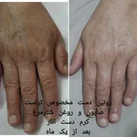 حراج محصولات پوست و مو