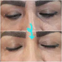 جشنواره بوتاکس مصپورت ۶۵۰فیلر ۶۹۰ فقط تا آخر آبان|خدمات آرایشگری و زیبایی|اصفهان, شمس آباد|دیوار