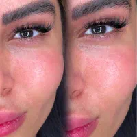 مدل برای کاشت هیدن چشم.فقط هزینه مواد.|خدمات آرایشگری و زیبایی|رشت, گلسار|دیوار