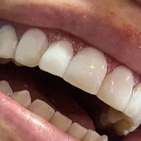 خدمات زیبایی دندان|خدمات آرایشگری و زیبایی|مشکین‌دشت, |دیوار