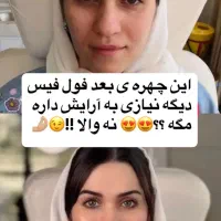 تخفیفات طلایی/ژل لب/ بوتاکس/ گونه/ فول فیس خط خنده|خدمات آرایشگری و زیبایی|مشهد, دانشجو|دیوار