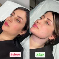 غبغب وی لاین با تخفیفات نوروزی مهرزاد