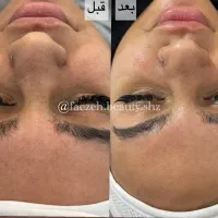 مدل فیشیال با تخفیف بابرند اکلادو|خدمات آرایشگری و زیبایی|شیراز, قالیشویی|دیوار