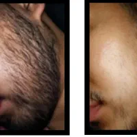 ریش دوست داری بیا پیشم