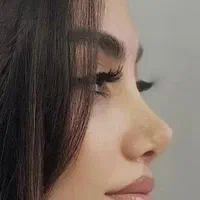 جشنواره عمل بینی