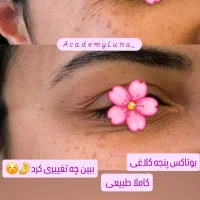 بوتاکس رایگان|خدمات آرایشگری و زیبایی|قم, زنبیل آباد|دیوار