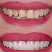 لبخند شما افتخار ماست|خدمات آرایشگری و زیبایی|اصفهان, باتون|دیوار