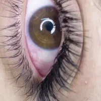 مدل رایگان اکستنشن