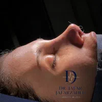 آف بینی مشاوره و نوبت دهی
