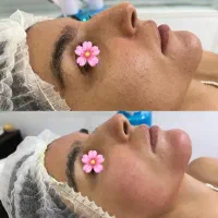 فیشیال و پاکسازی تخصصی پوست بانوان در زاهدان