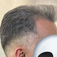 اصلا مو
