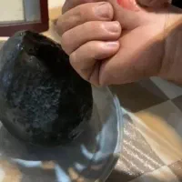 سنگ پادزهر