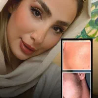 ریش سبیل تضمینی بدون بازگشت