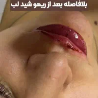 ریمو تتو|خدمات آرایشگری و زیبایی|میانه, |دیوار