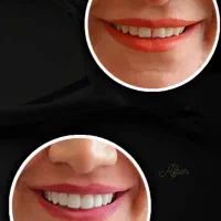 دندانپزشکی اقساطی باارائه وام و با کیفیتی استثنایی|خدمات آرایشگری و زیبایی|شیراز, ملاصدرا|دیوار