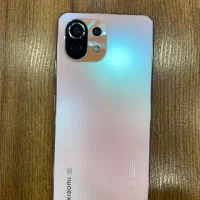 شیامی ۱۱لایت 5G