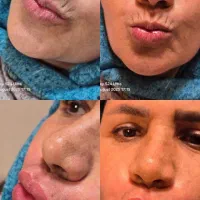 مرکز زیبایی لیزا