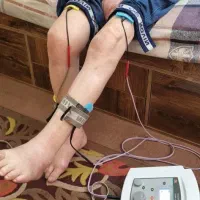 فیزیوتراپی در منزل تهران