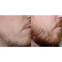 بدرخش|آرایشی، بهداشتی، درمانی|حمیدیا, |دیوار