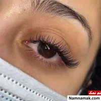 کاشت مژه هیدن ۲۰۰