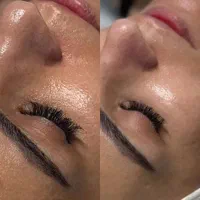 فیشیال پاکسازی پوست