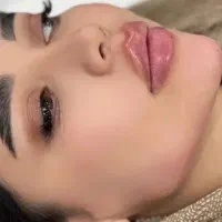 ژل لب|خدمات زیبایی و سلامت|تهران, اتحاد|دیوار