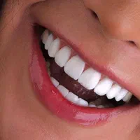 تمامی خدمات دندانپزشکی و کامپوزیت و فیسینگ|خدمات آرایشگری و زیبایی|شیراز, فرهنگ شهر|دیوار