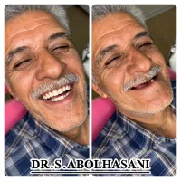 جشنواره لمینت فقط با ده تومن پیش پرداخت اصفهان|خدمات آرایشگری و زیبایی|شهرکرد, |دیوار