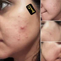 پوست کره ای|خدمات آرایشگری و زیبایی|ارومیه, |دیوار