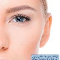 جشنواره تخفیفی بوتاکس در محیط لوکس