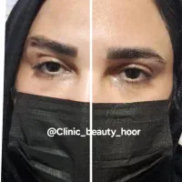 کلینیک زیبایی گلد( فیلر ژل بوتاکس) توسط پزشک|خدمات آرایشگری و زیبایی|سنندج, |دیوار