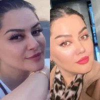 جراحی بینی باتخفیف ویژه جشنواره