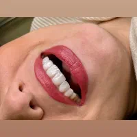 دندانپزشکی زیبایی جشنواره 50 درصدی با ضمانت|خدمات آرایشگری و زیبایی|تهران, نیاوران|دیوار