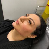 تزریق ژل و بوتاکس لیفت نخ جدیدترین متد مطب زیبایی|خدمات آرایشگری و زیبایی|کرج, گوهردشت|دیوار