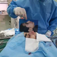 عمل بینی فقط با 50میلیون