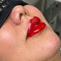 تزریق ژل و بوتاکس|خدمات آرایشگری و زیبایی|ارومیه, |دیوار