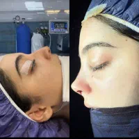 جراحی بینی/پیکرتراشی/لیفت صورت